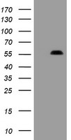 PHF7 Antibody - HEK293T cells were transfected with the pCMV6-ENTRY control (Left lane) or pCMV6-ENTRY PHF7 (Right lane) cDNA for 48 hrs and lysed. Equivalent amounts of cell lysates (5 ug per lane) were separated by SDS-PAGE and immunoblotted with anti-PHF7.