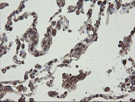 PHF7 Antibody - IHC of paraffin-embedded Human lung tissue using anti-PHF7 mouse monoclonal antibody.