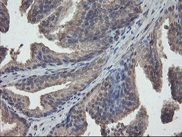 PHF7 Antibody - IHC of paraffin-embedded Human prostate tissue using anti-PHF7 mouse monoclonal antibody.
