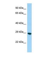 PHF7 Antibody - Western blot of Mouse Testis. Phf7 antibody dilution 1.0 ug/ml.  This image was taken for the unconjugated form of this product. Other forms have not been tested.