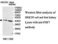 PHF7 Antibody