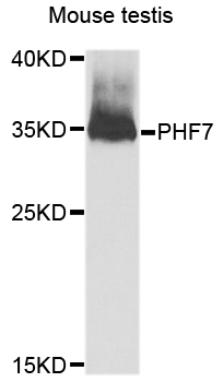 PHF7 Antibody - Western blot analysis of extracts of Mouse testis cells.