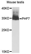 PHF7 Antibody - Western blot analysis of extracts of Mouse testis cells.