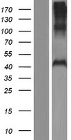 PHF7 Protein - Western validation with an anti-DDK antibody * L: Control HEK293 lysate R: Over-expression lysate