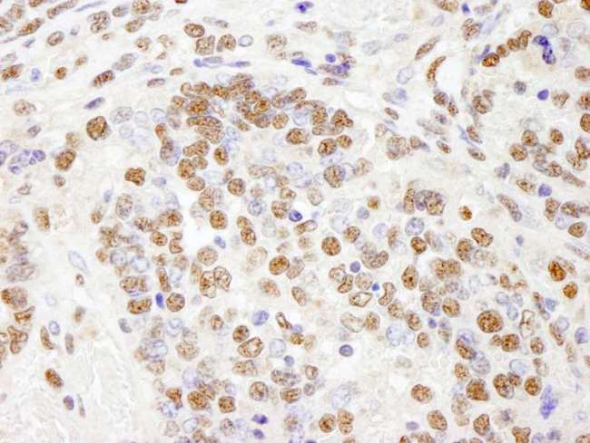 PHF8 Antibody - Detection of Mouse PHF8 by Immunohistochemistry. Sample: FFPE section of mouse teratoma. Antibody: Affinity purified rabbit anti-PHF8 used at a dilution of 1:100.