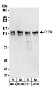 PHF8 Antibody - Detection of Human PHF8 by Western Blot. Samples: Whole cell lysate (50 ug) from HeLa, HeLa (RIPA), 293T, and Jurkat cells. Antibodies: Affinity purified rabbit anti-PHF8 antibody used for WB at 0.04 ug/ml. Detection: Chemiluminescence with an exposure time of 30 seconds.