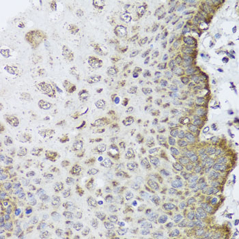 PHF9 / FANCL Antibody - Immunohistochemistry of paraffin-embedded human esophagus.
