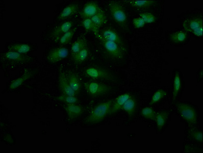 PHF9 / FANCL Antibody - Immunofluorescence staining of Hela cells at a dilution of 1:200, counter-stained with DAPI. The cells were fixed in 4% formaldehyde, permeabilized using 0.2% Triton X-100 and blocked in 10% normal Goat Serum. The cells were then incubated with the antibody overnight at 4 °C.The secondary antibody was Alexa Fluor 488-congugated AffiniPure Goat Anti-Rabbit IgG (H+L) .