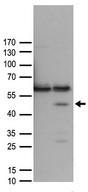 PHF9 / FANCL Antibody - HEK293T cells were transfected with the pCMV6-ENTRY control. (Left lane) or pCMV6-ENTRY FANCL. (Right lane) cDNA for 48 hrs and lysed