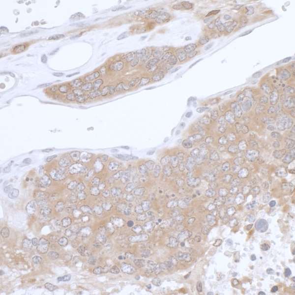 PHGDH Antibody - Detection of mouse PHGDH by immunohistochemistry. Sample: FFPE section of mouse teratoma. Antibody: Affinity purified rabbit anti- PHGDH used at a dilution of 1:1,000 (1µg/ml). Detection: DAB