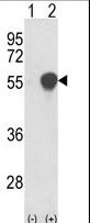 PHGDH Antibody - Western blot of PHGDH (arrow) using rabbit polyclonal PHGDH Antibody. 293 cell lysates (2 ug/lane) either nontransfected (Lane 1) or transiently transfected with the PHGDH gene (Lane 2).