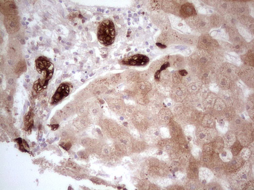 PHGDH Antibody - Immunohistochemical staining of paraffin-embedded Human liver tissue within the normal limits using anti-PHGDH mouse monoclonal antibody. (Heat-induced epitope retrieval by 1 mM EDTA in 10mM Tris, pH8.5, 120C for 3min,