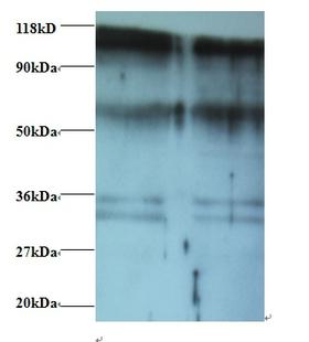 PHGDH Antibody - Western blot of D-3-phosphoglycerate dehydrogenase antibody at 2 ug/ml. Lane 1: EC109whole cell lysate. Lane 2: 293T whole cell lysate. Secondary: Goat polyclonal to Rabbit IgG at 1:15000 dilution. Predicted band size: 59 kDa. Observed band size: 70 kDa Additional bands at: 100 kDa. 36 kDa. We are unsure as to the identity of these extra bands.  This image was taken for the unconjugated form of this product. Other forms have not been tested.