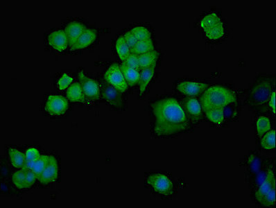 PHGDH Antibody - Immunofluorescent analysis of PC-3 cells using PHGDH Antibody at dilution of 1:100 and Alexa Fluor 488-congugated AffiniPure Goat Anti-Rabbit IgG(H+L)
