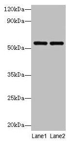 PHGDH Antibody - Western blot All lanes: D-3-phosphoglycerate dehydrogenase antibody at 2µg/ml Lane 1: EC109 whole cell lysate Lane 2: 293T whole cell lysate Secondary Goat polyclonal to rabbit IgG at 1/10000 dilution Predicted band size: 59 kDa Observed band size: 59 kDa