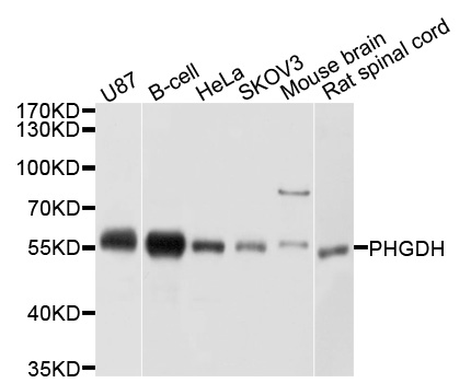 PHGDH Antibody - Western blot analysis of extracts of various cell lines, using PHGDH antibody at 1:1000 dilution. The secondary antibody used was an HRP Goat Anti-Rabbit IgG (H+L) at 1:10000 dilution. Lysates were loaded 25ug per lane and 3% nonfat dry milk in TBST was used for blocking. An ECL Kit was used for detection and the exposure time was 5s.