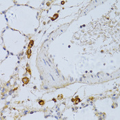 PHGDH Antibody - Immunohistochemistry of paraffin-embedded rat lung using PHGDH antibodyat dilution of 1:100 (40x lens).