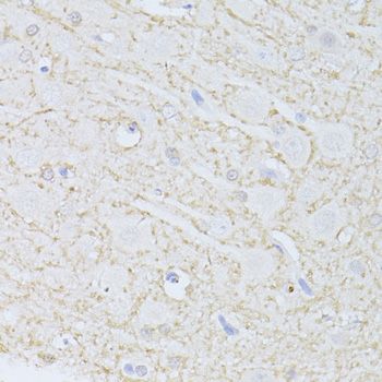 PHGDH Antibody - Immunohistochemistry of paraffin-embedded rat brain using PHGDH antibodyat dilution of 1:100 (40x lens).