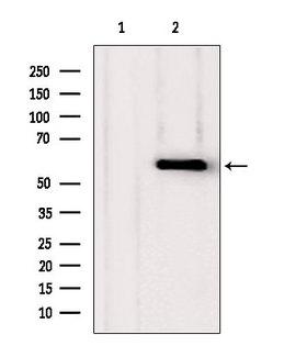 PHGDH Antibody - Western blot analysis of extracts of various samples using PHGDH antibody. Lane 1: HeLa treated with blocking peptide. Lane 2: HeLa; Lane 3: HepG2;