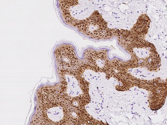 PHGDH Antibody - Immunochemical staining of human PHGDH in human skin with rabbit polyclonal antibody at 1:100 dilution, formalin-fixed paraffin embedded sections.