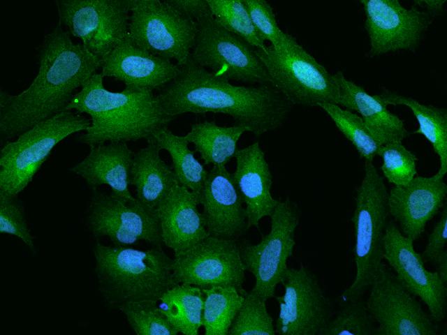 PHGDH Antibody - Immunofluorescence staining of PHGDH in U2OS cells. Cells were fixed with 4% PFA, permeabilzed with 0.1% Triton X-100 in PBS, blocked with 10% serum, and incubated with rabbit anti-Human PHGDH polyclonal antibody (dilution ratio 1:200) at 4°C overnight. Then cells were stained with the Alexa Fluor 488-conjugated Goat Anti-rabbit IgG secondary antibody (green) and counterstained with DAPI (blue). Positive staining was localized to Cytoplasm.