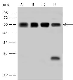 PHGDH Antibody - Anti-PHGDH rabbit polyclonal antibody at 1:500 dilution. Lane A: A431 Whole Cell Lysate. Lane B: Raji Whole Cell Lysate. Lane C: HeLa Whole Cell Lysate. Lane D: Jurkat Whole Cell Lysate. Lysates/proteins at 30 ug per lane. Secondary: Goat Anti-Rabbit IgG (H+L)/HRP at 1/10000 dilution. Developed using the ECL technique. Performed under reducing conditions. Predicted band size: 57 kDa. Observed band size: 55 kDa.