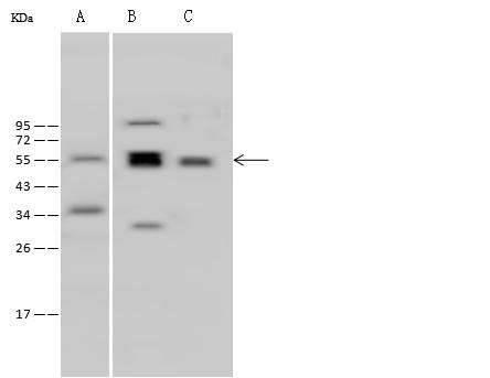 PHGDH Antibody - Anti-PHGDH rabbit polyclonal antibody at 1:500 dilution. Lane A: A431 Whole Cell Lysate. Lane B: HeLa Whole Cell Lysate. Lane C: Jurkat Whole Cell Lysate. Lysates/proteins at 30 ug per lane. Secondary: Goat Anti-Rabbit IgG (H+L)/HRP at 1/10000 dilution. Developed using the ECL technique. Performed under reducing conditions. Predicted band size: 57 kDa. Observed band size: 57 kDa.