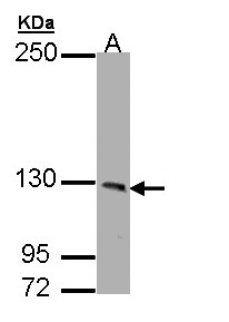 PHKA1 Antibody - Sample (30 ug of whole cell lysate). A: HeLa. 7.5% SDS PAGE. PHKA1 antibody diluted at 1:1000