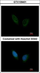 PHKA1 Antibody - Immunofluorescence of methanol-fixed HeLa using PHKA1 antibody at 1:200 dilution.