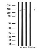 PHKA1 + PHKA2 Antibody - Western blot analysis of Histone KPB1/2 expression in various lysates