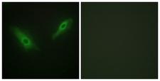 PHKA1 + PHKA2 Antibody - Immunofluorescence analysis of HeLa cells, using KPB1/2 Antibody. The picture on the right is blocked with the synthesized peptide.