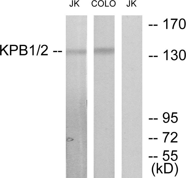 PHKA1 + PHKA2 Antibody - Western blot analysis of lysates from Jurkat and COLO205 cells, using KPB1/2 Antibody. The lane on the right is blocked with the synthesized peptide.