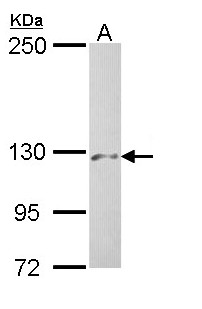 PHKA2 Antibody - Sample (30 ug of whole cell lysate). A: Hep G2 . 5% SDS PAGE. PHKA2 antibody diluted at 1:500.
