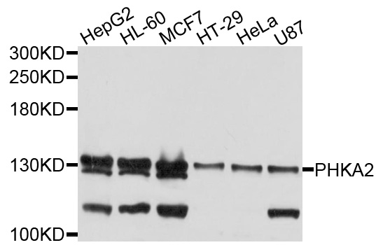 PHKA2 Antibody - Western blot analysis of extracts of various cells.