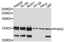 PHKA2 Antibody - Western blot analysis of extracts of various cells.