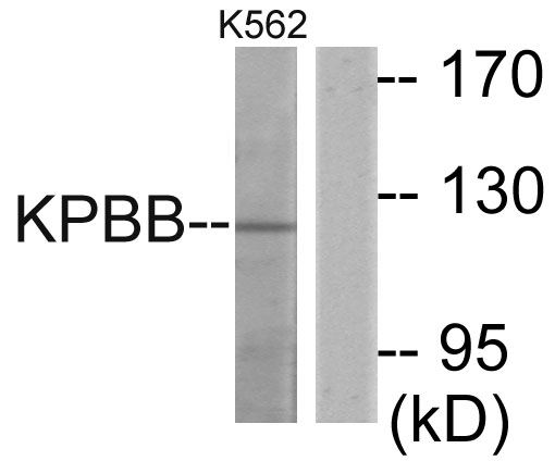 PHKB Antibody - Western blot analysis of lysates from K562 cells, using KPBB Antibody. The lane on the right is blocked with the synthesized peptide.