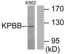 PHKB Antibody - Western blot analysis of lysates from K562 cells, using KPBB Antibody. The lane on the right is blocked with the synthesized peptide.