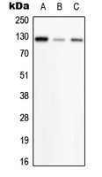 PHKB Antibody - Western blot analysis of PHKB expression in HeLa (A); SP2/0 (B); H9C2 (C) whole cell lysates.