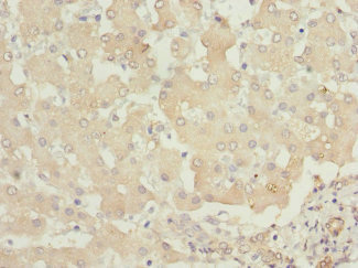 PHKB Antibody - Immunohistochemistry of paraffin-embedded human liver tissue at dilution 1:100