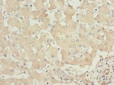 PHKB Antibody - Immunohistochemistry of paraffin-embedded human liver tissue at dilution 1:100
