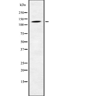 PHKB Antibody - Western blot analysis of PHKB using K562 whole cells lysates