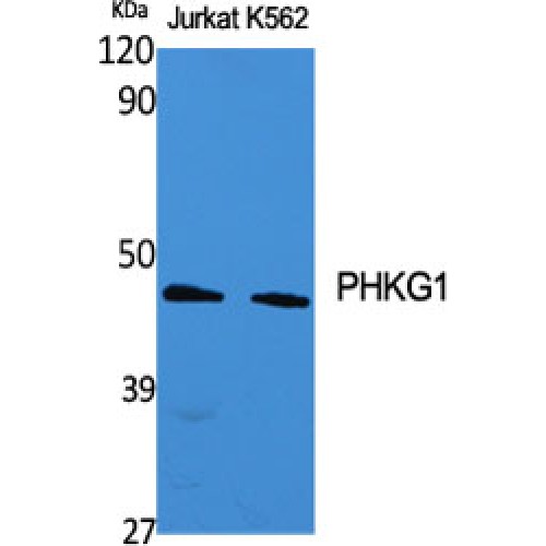 PHKG1 Antibody - Western blot of PHKG1 antibody