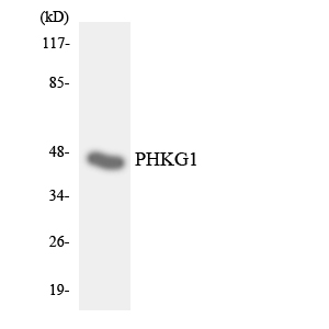 PHKG1 Antibody - Western blot analysis of the lysates from HUVECcells using PHKG1 antibody.