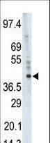 PHKG1 Antibody - Western blot of anti-PHKG1 antibody in A375 cell lysate. PHKG1 (arrow) was detected using purified antibody. Secondary HRP-anti-rabbit was used for signal visualization with chemiluminescence.