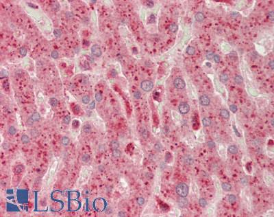 PHKG1 Antibody - Human Liver: Formalin-Fixed, Paraffin-Embedded (FFPE).  This image was taken for the unconjugated form of this product. Other forms have not been tested.