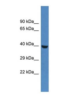 PHKG1 Antibody - Anti-PHKG1 antibody western blot of Rat Liver lysate. Antibody concentration 1 ug/ml.  This image was taken for the unconjugated form of this product. Other forms have not been tested.