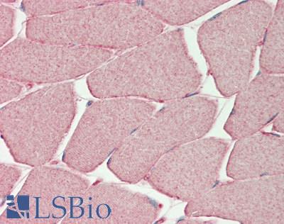 PHKG1 Antibody - Human Sketetal Muscle: Formalin-Fixed, Paraffin-Embedded (FFPE).  This image was taken for the unconjugated form of this product. Other forms have not been tested.