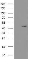 PHKG2 Antibody - HEK293T cells were transfected with the pCMV6-ENTRY control (Left lane) or pCMV6-ENTRY PHKG2 (Right lane) cDNA for 48 hrs and lysed. Equivalent amounts of cell lysates (5 ug per lane) were separated by SDS-PAGE and immunoblotted with anti-PHKG2.
