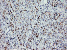 PHKG2 Antibody - IHC of paraffin-embedded Human pancreas tissue using anti-PHKG2 mouse monoclonal antibody. (Heat-induced epitope retrieval by 10mM citric buffer, pH6.0, 100C for 10min).