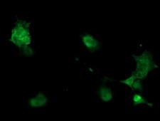 PHKG2 Antibody - Anti-PHKG2 mouse monoclonal antibody immunofluorescent staining of COS7 cells transiently transfected by pCMV6-ENTRY PHKG2.